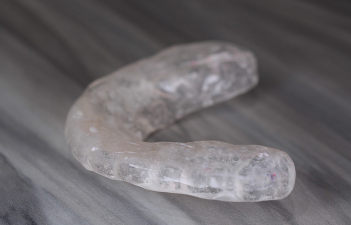 スプリント療法（顎関節用マウスピースの作製）